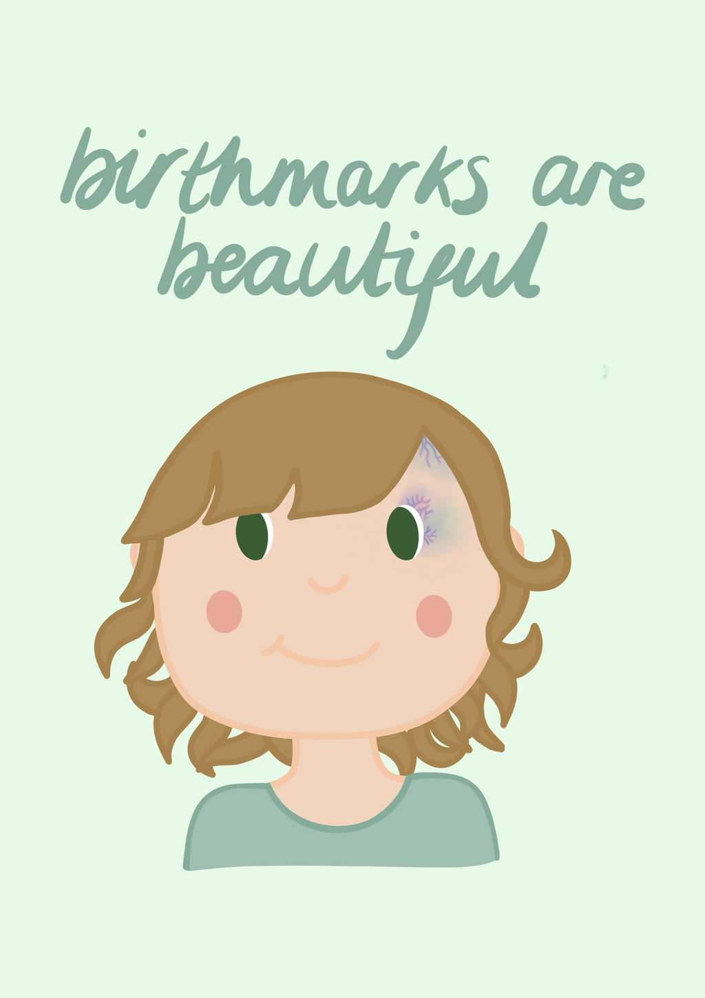 Birthmarks are Beautiful Print