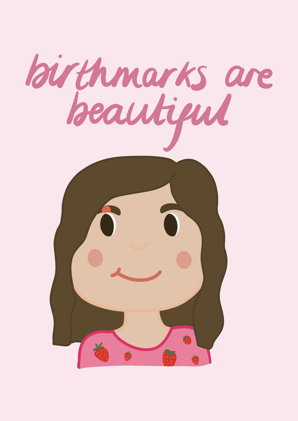 Birthmarks are Beautiful Print