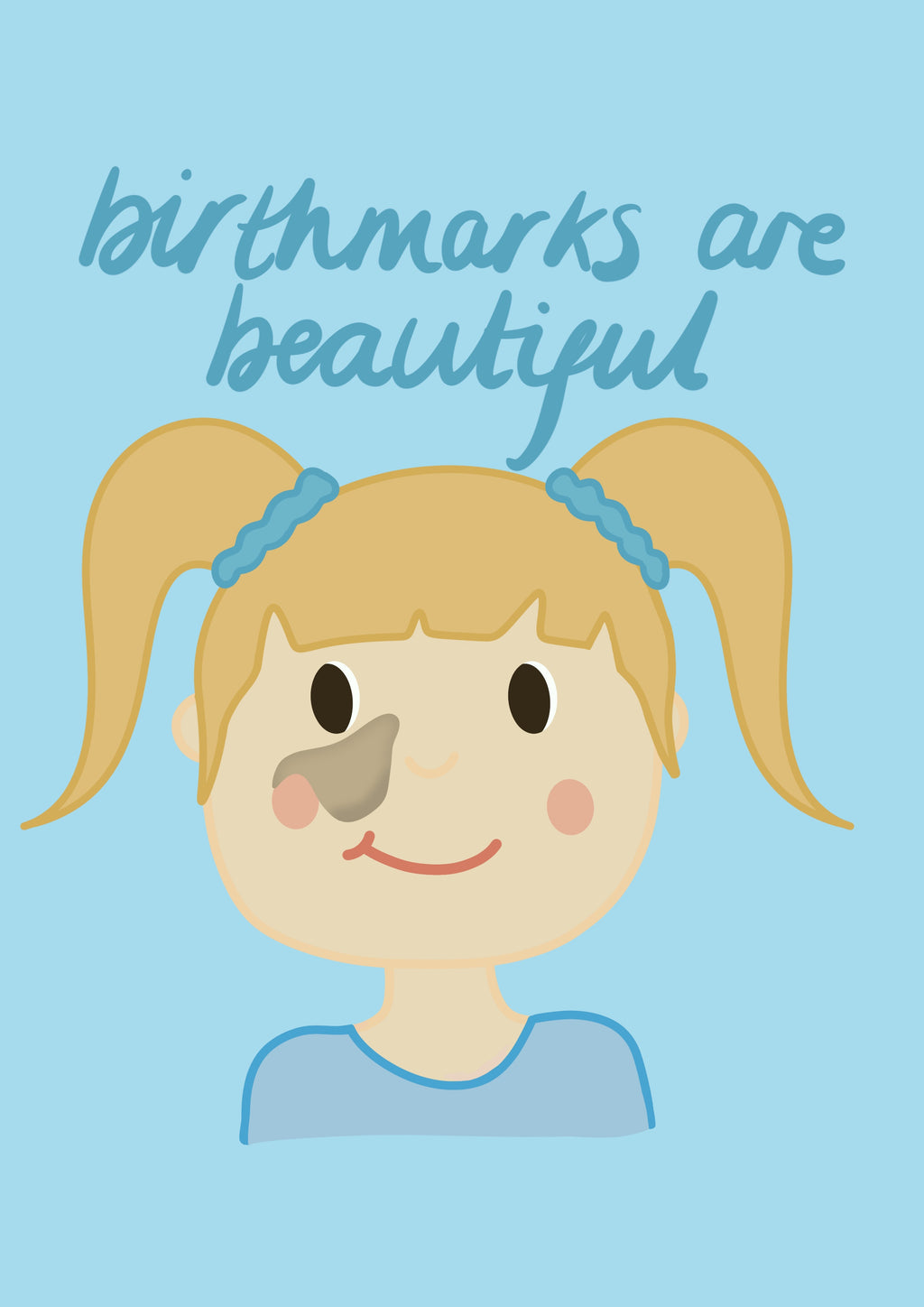 Birthmarks are Beautiful Print