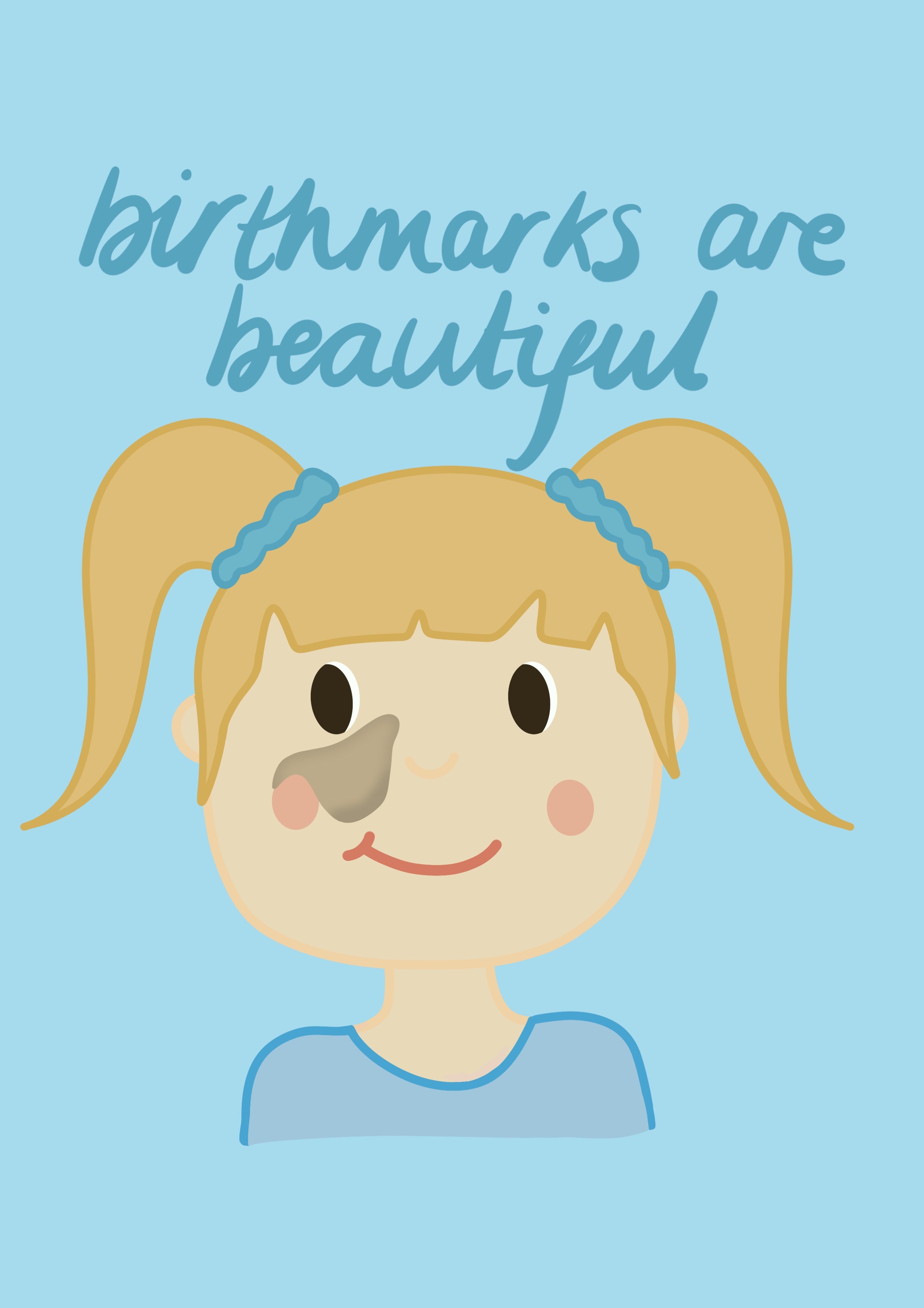 Birthmarks are Beautiful Print